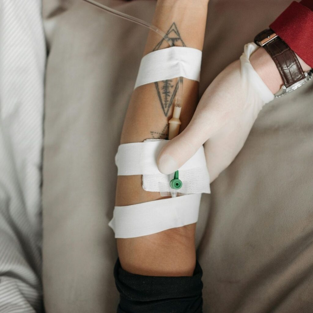 arm set up with an IV